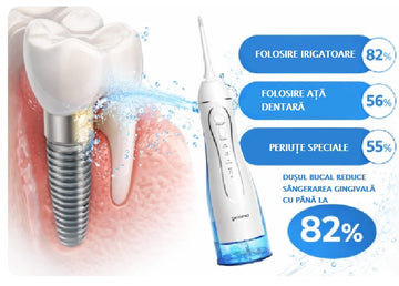 igienizare lucrari dentare