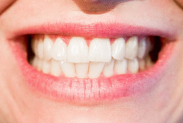 prevenirea bolilor parodontale