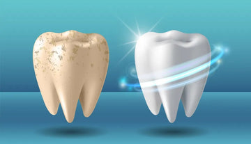 Cum să-ți menții dintii sănătoși: ghidul complet al igienei orale